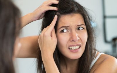 頭皮痘痘怎麼辦?從洗頭開始戰痘